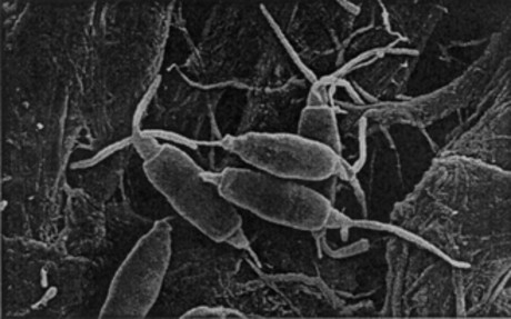 Pestalotiopsis microspora: hongo que descompone el plástico